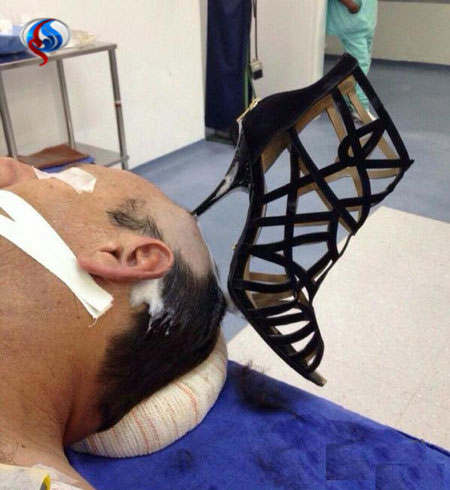 فرو کردن پاشنه کفش درون سر همسر توسط زن عربستانی