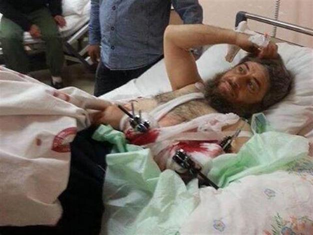 رهبر داعش در بیمارستان ترکیه (+عکس)