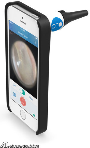 تشخیص عفونت گوش با گجت ویژه موبایل هوشمند