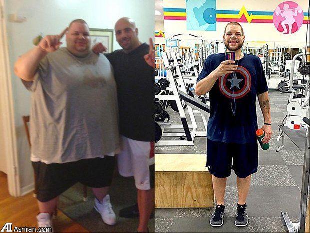 مردی پس از ۱۸۰ کیلو کاهش وزن !+عکس 