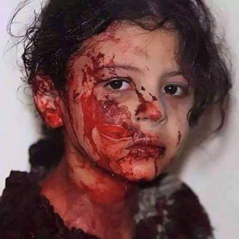 عربستان انتقام جمعه خونین را از کودکان می گیرد (عکس18+)