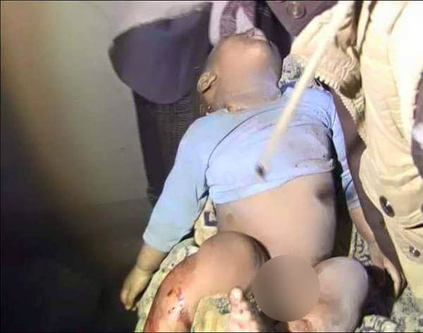 عربستان انتقام جمعه خونین را از کودکان می گیرد (عکس18+)