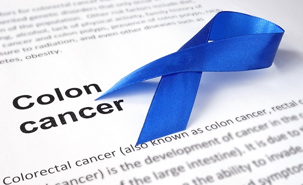 6 نشانه اولیه ابتلا به سرطان روده بزرگ
