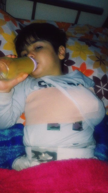 شکستن استخوان ترقوه‌ پسر 3 ساله در مهدکودک/ تایید حادثه کودک‌آزاری (+عکس)