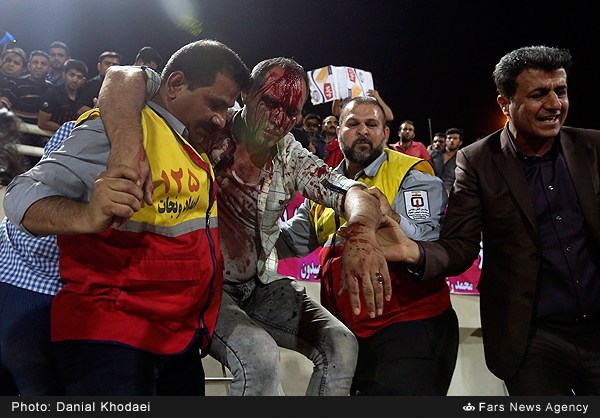تصاویر خشونت آمیز از خونریزی در ورزشگاه غدیر«13+»