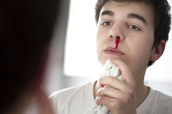 راه حل‌های خانگی برای توقف خونریزی بینی