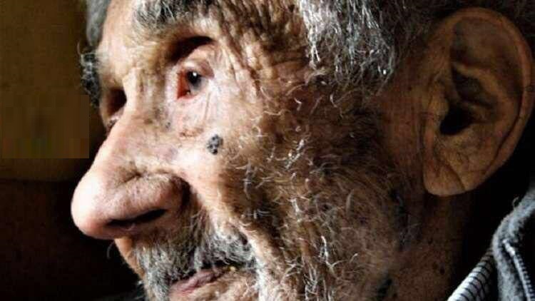 پیرترین انسان جهان در ایران است؟ (+عکس) 