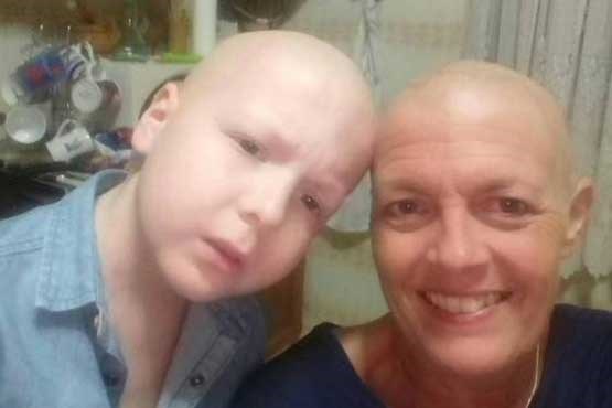 مادر و پسری که همزمان به سرطان مبتلا شدند (+عکس)