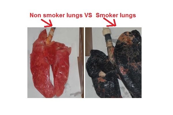 تاثیر سیگار کشیدن بر ریه‌ها به روایت تصویر