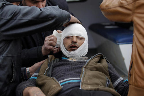 زخمی شدن یک نیروی مسلح مخالف حکومت سوریه در انفجار مین – منطقه الباب در شمال سوریه