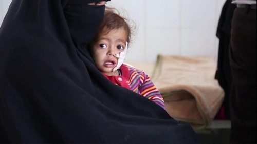 کودکان بیمار در کشور جنگزده یمن با مشکلات زیادی روبه رو هستند. یمن هم اکنون توسط ائتلاف نظامی عربستان سعودی در محاصره است و از سوی این ائتلاف مورد حملات نظامی مختلف قرار می گیرد