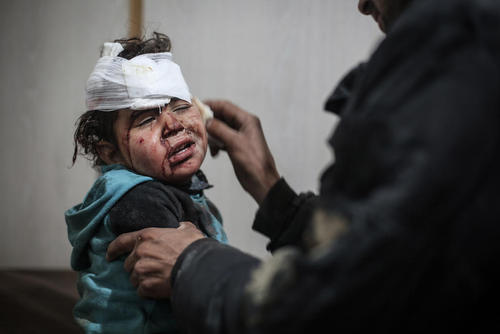 مداوای یک کودک آسیب دیده از حملات هوایی در منطقه غوطه شرقی در سوریه/عکس: DPA