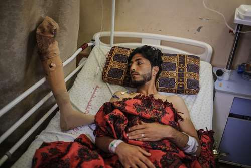 یک زخمی معلول فلسطینی در بیمارستانی در باریکه غزه؛ این مرد در اثر اصابت گلوله سربازان اسراییلی در مرز غزه زخمی شده است/ عکس:آناتولی