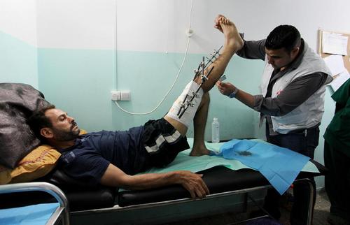 یک فلسطینی زخمی شده به دست سربازان ارتش اسراییل در حال مداوا در کلینیک 