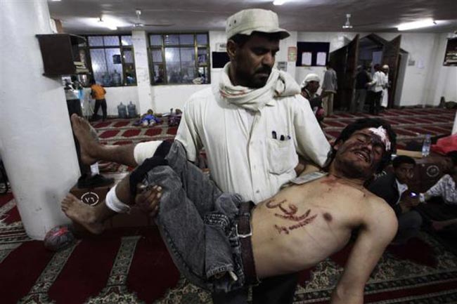 مجروح یمنی