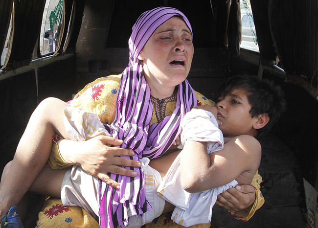 کودک زخمی سوری