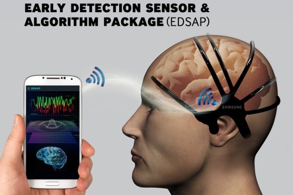 تشخیص سکته مغزی با تلفن هوشمند