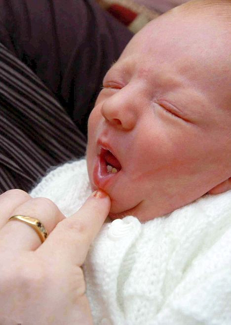 تولد نوزادی با دو دندان کامل (+عکس)