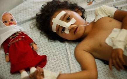 تصاویری دلخراش از روزگار کودکان غزه (16+)