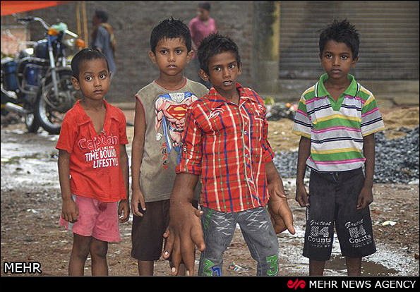 کودک هندی با دستان غول پیکر‎ (عکس)