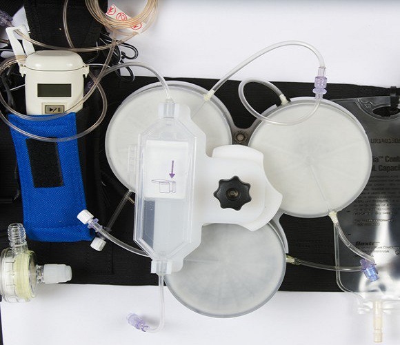 تایید عملکرد نخستین کلیه مصنوعی پوشیدنی جهان