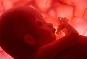 علل سقط مکرر در بارداری‌ها