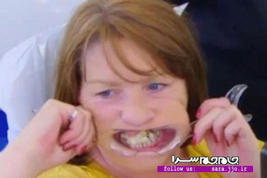 10 سال چسب کاری به خاطر ترس از پزشک! (+عکس)