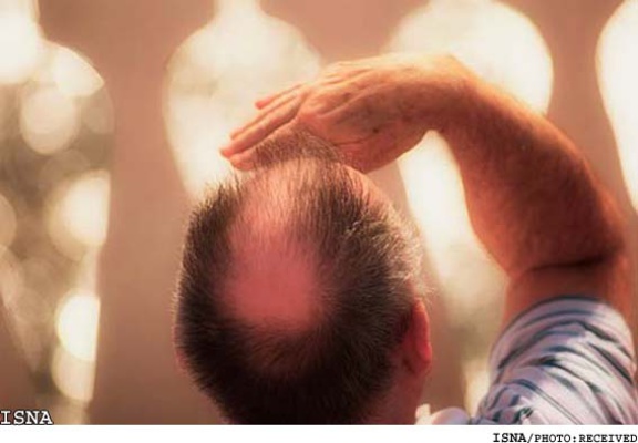 سرطان پوست در کمین مردان طاس!