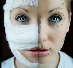 افزایش جراحی های زیبایی غیر استاندارد در ایران