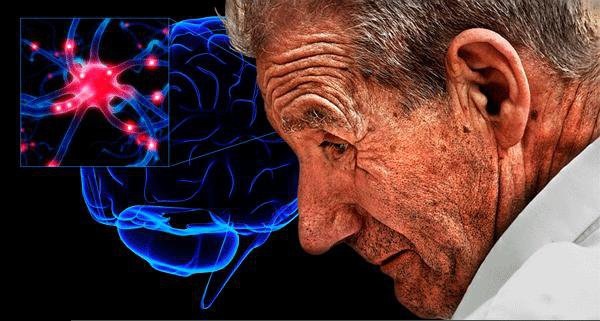 احتمال شروع پارکینسون از روده‌ها