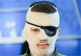 گرهی کور در یک پرونده قصاص چشم