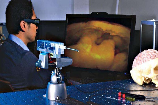 دوربین کوچک سه‌بعدی برای جراحی‌ نوآورانه مغز