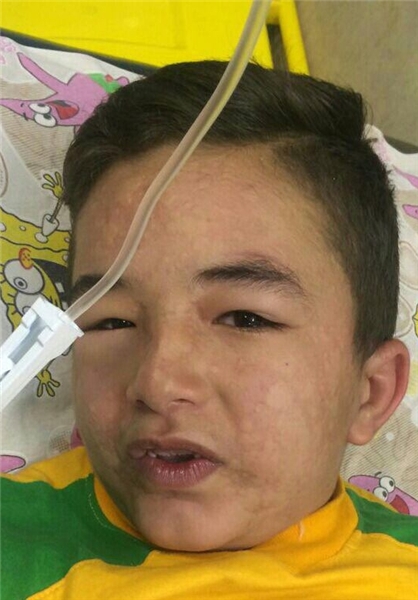 ماجرای شوک کودک ۸ ساله پس از تزریق پنی‌سیلین+تصویر