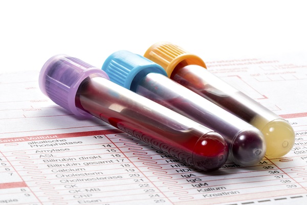 مشکلات سلامت که با آزمایش خون آشکار می‌شوند