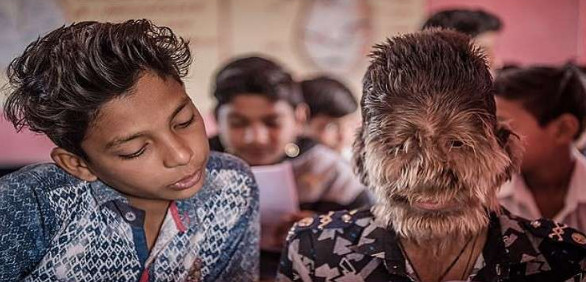 ماجرای حیرت‌آور پسربچه گرگ‌نما در هند (+عکس)
