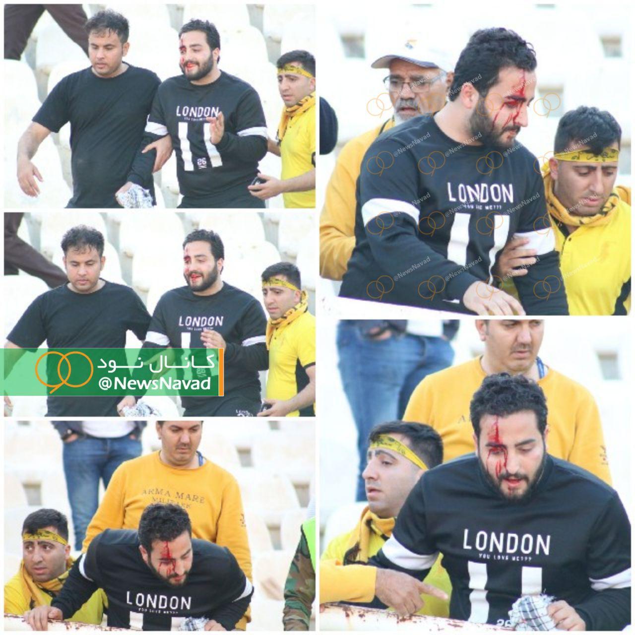 باز هم سنگ و خون در غدیر اهواز (عکس)