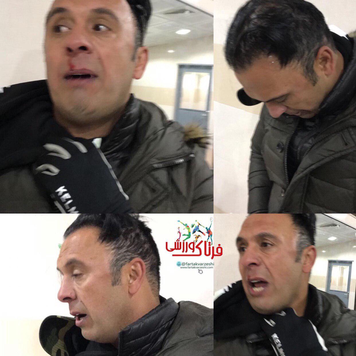 درگیری در لیگ دو/ بینی سرمربی شهرداری ماهشهر شکست (+عکس)