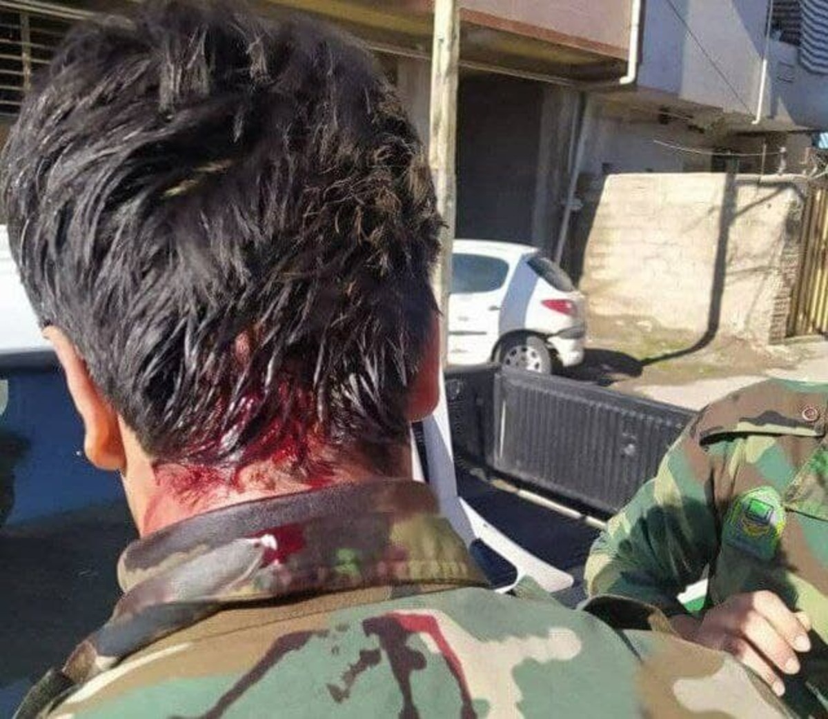 زخمی شدن یک جنگلبان با سلاح سرد در گلستان