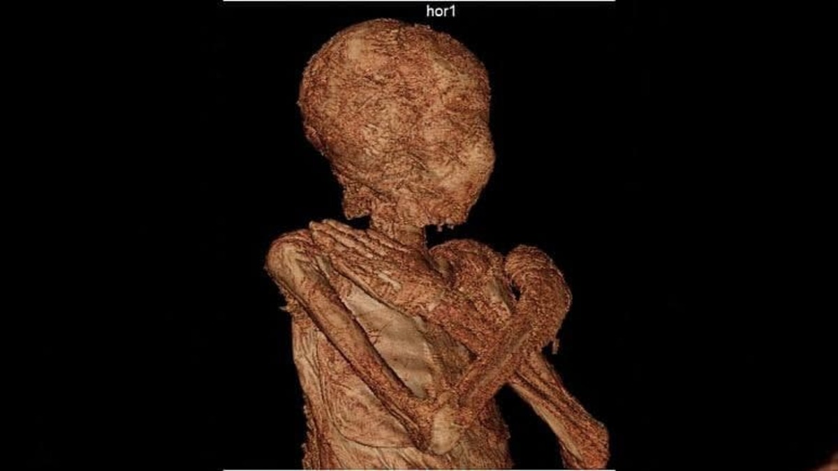 محققان از راز حفظ جنین در بدن زن مومیایی 2 هزار ساله پرده برداشتند