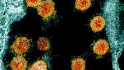 امریکا: محقق چینی نمونه‌های نخستین ویروس کرونا در ووهان را از پایگاه داده آمریکا حذف کرده است