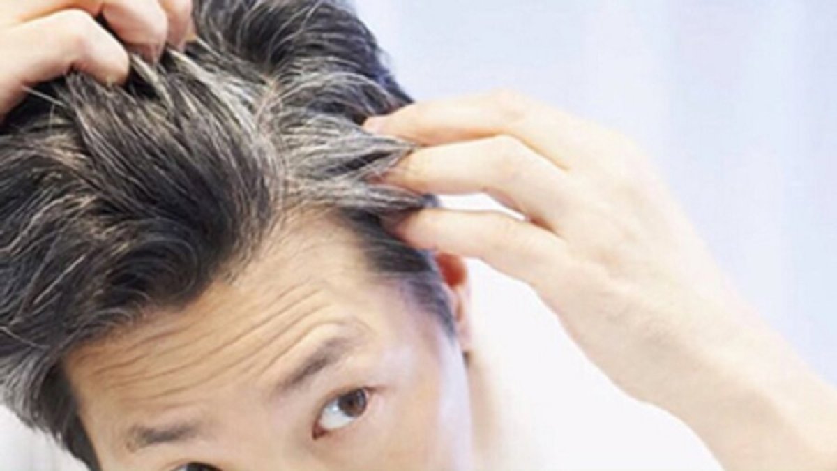 چند راهکار ساده برای دیرتر سفید شدن موهای سر