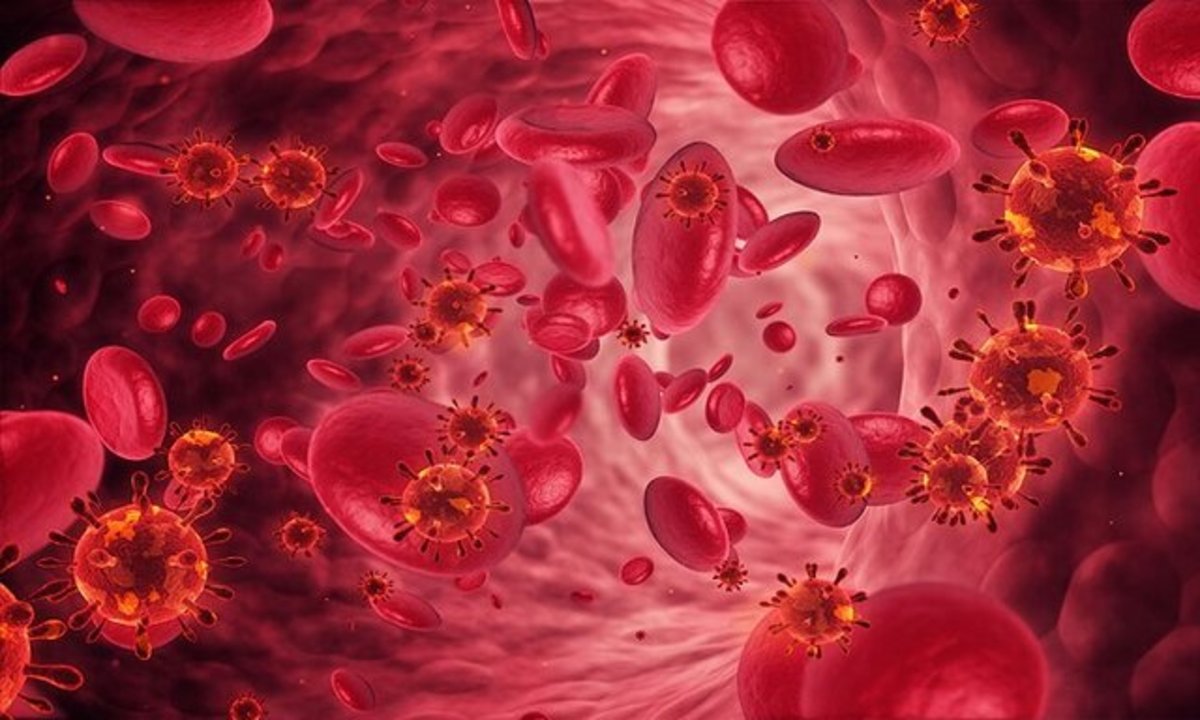 علائم کم خونی در مردان چیست؟