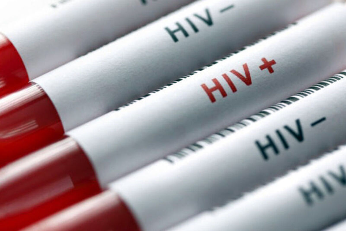 انجام بیش از ۱۰۰ هزار تست تشخیص ایدز در کشور
