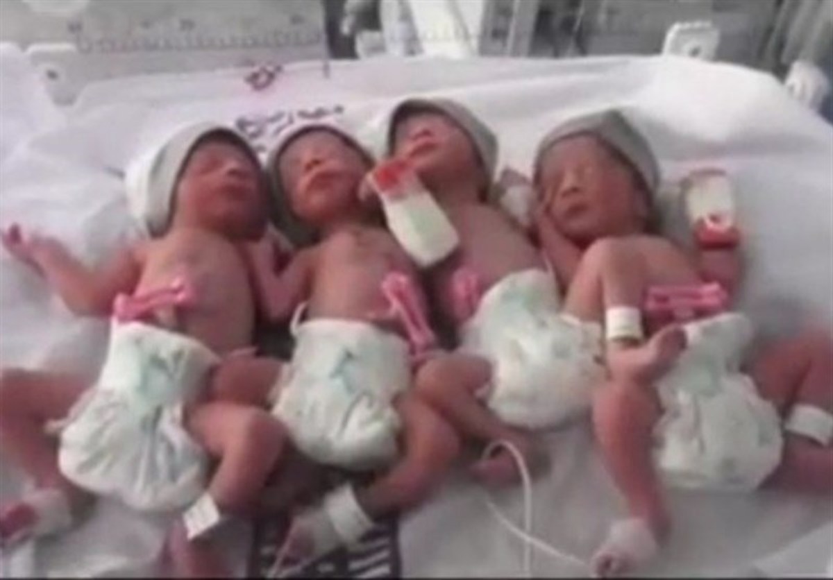 نوزادان 4 قلو در گناباد متولد شدند