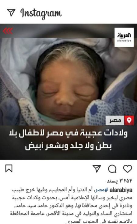 تولد نوزادانی عجیب در مصر (+عکس)