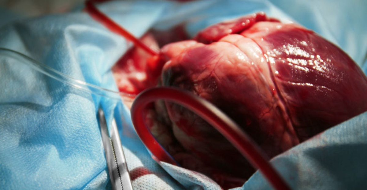 ببینید| چگونگی عمل جراحی پیوند قلب