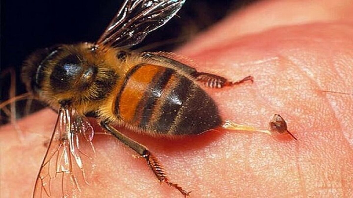 ببینید| عاقبت زنبور خوردن مرد چینی