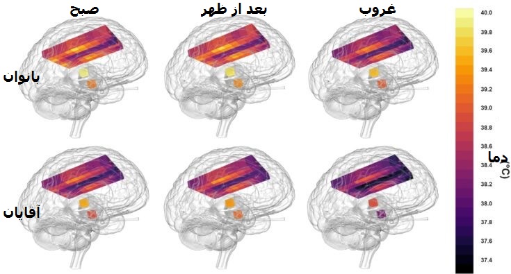 مغز زنان داغ تر است!/ یک کشف جالب در نقشه 4 بعدی دمای مغز(+عکس)