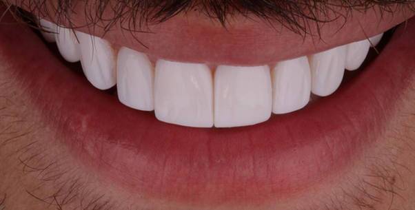 روش های کاهش هزینه درمانی چیست؟