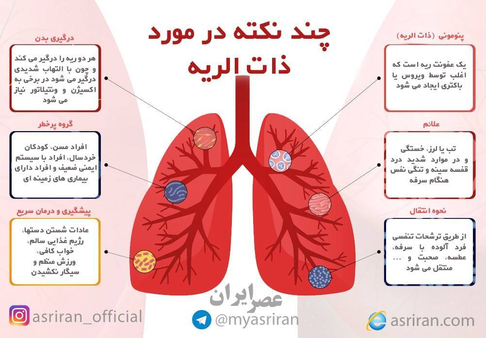چند نکته درباره ذات الریه (اینفوگرافیک)